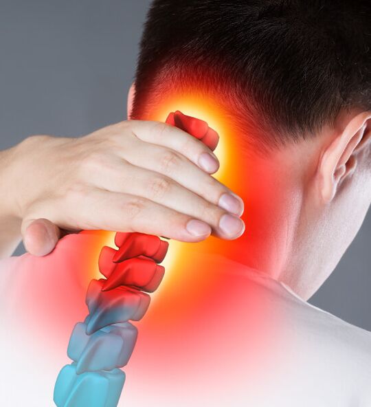 Síntomas dunha osteocondrose pescozo