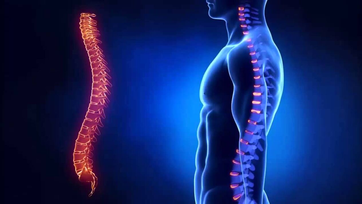A osteocondrose clasifícase segundo as partes da columna nas que se desenvolve a enfermidade.